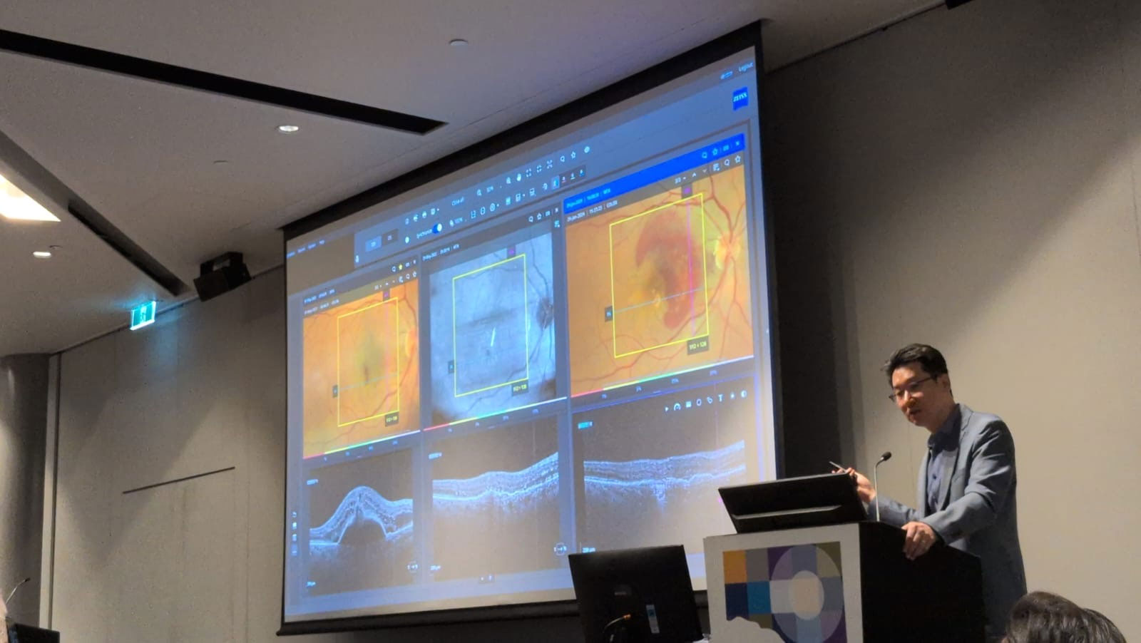Dr John Chang presenting at RANZCO 2024 in Adelaide